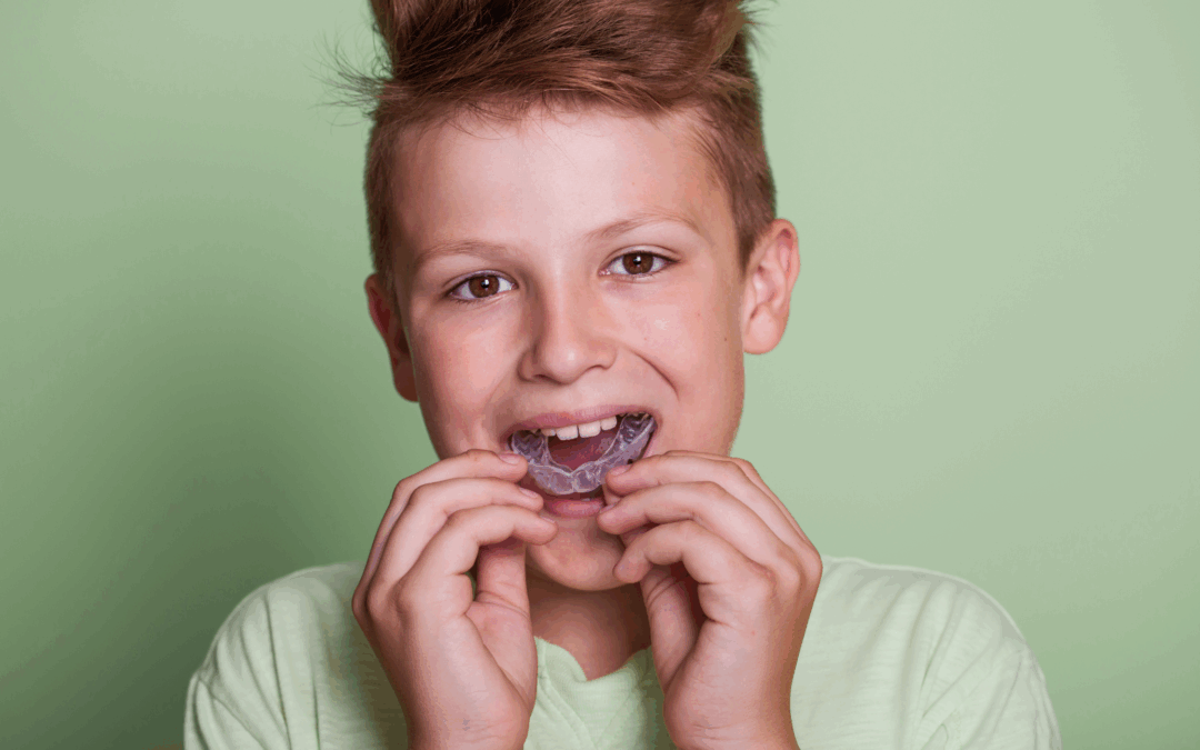 How to Choose the Right Mouthguard in Logan: A Dentist’s Guide