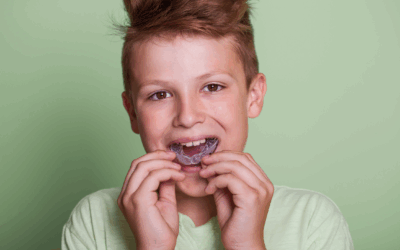 How to Choose the Right Mouthguard in Logan: A Dentist’s Guide